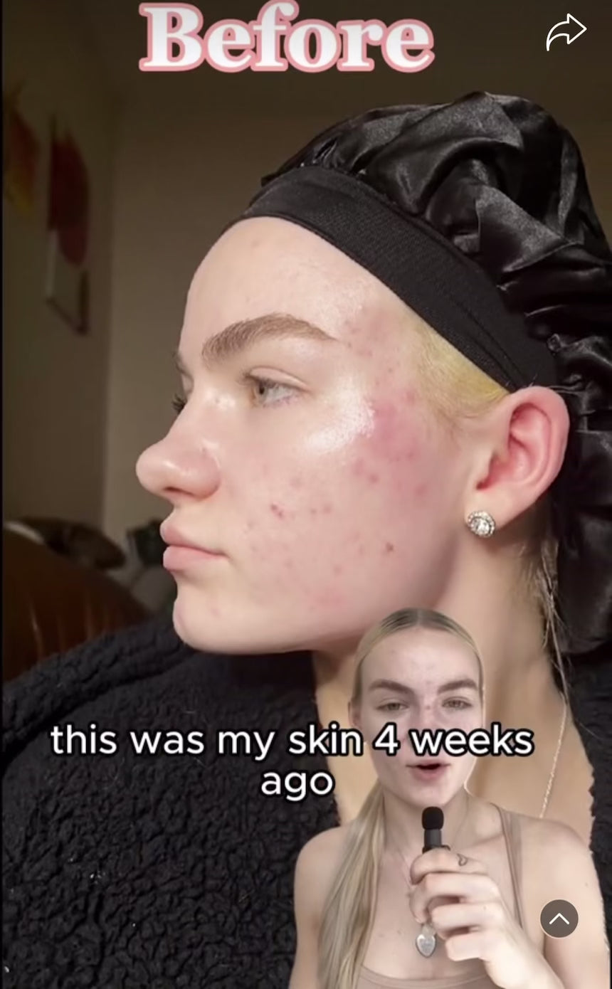 LIGHT AURA - Face Mask video